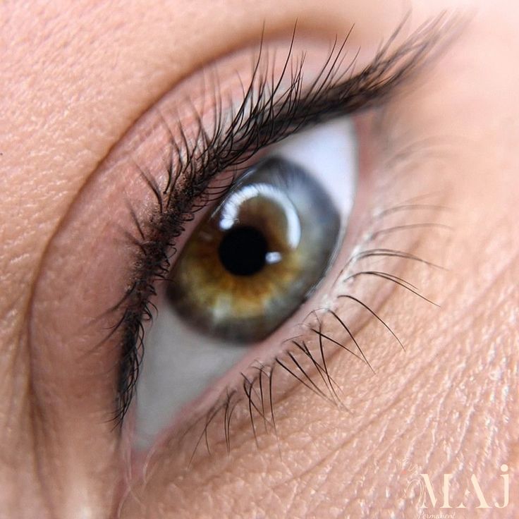Wimpernkranzverdichtung