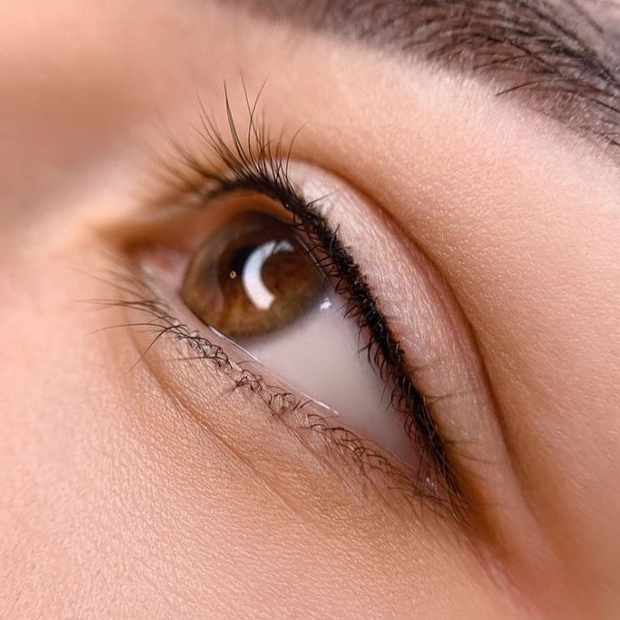 Wimpernkranzverdichtung